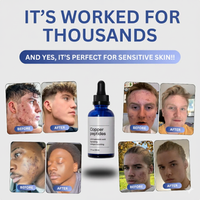 GHK-Cu-Peptidserum