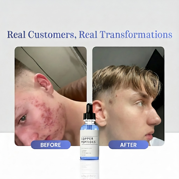 GHK-Cu-Peptidserum